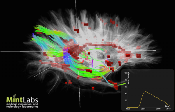 Mint Labs un Mapa de Google del Cerebro Humano Busca Inversión en Capital Cell